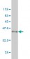 CSE1L Antibody (monoclonal) (M01)